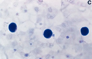 view Fragile X diagnostic test - male, no stain