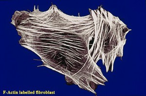 view F-actin labelled fibroblast.