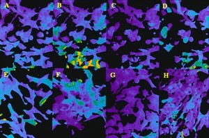 view Inhibition of Ca emission by fibroblasts