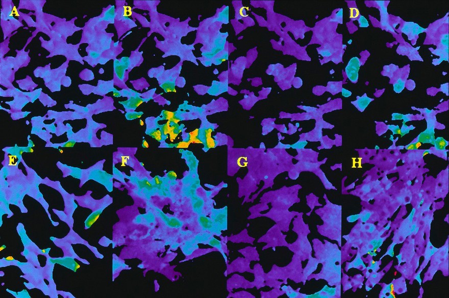 Inhibition of Ca emission by fibroblasts