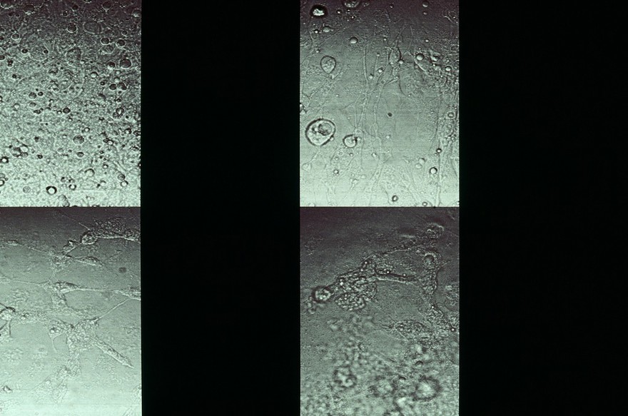 GFP fluorescence studies, untransfected cell