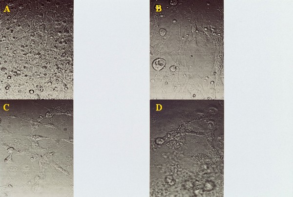 GFP fluorescence studies, untransfected cell