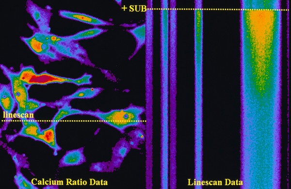 Ca++ fluroescence response to Indo-1,fibrobl