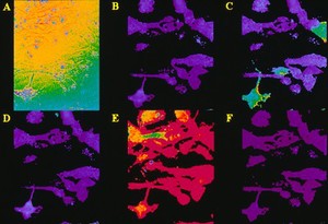 view Fibroblast responses to acetylcholine