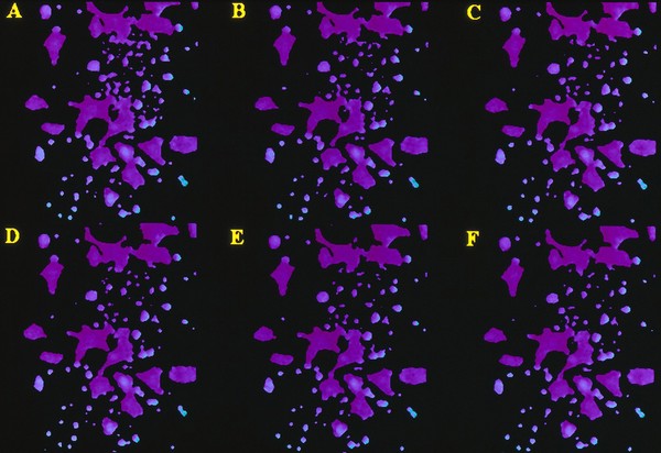 Fibroblast responses to acetylcholine