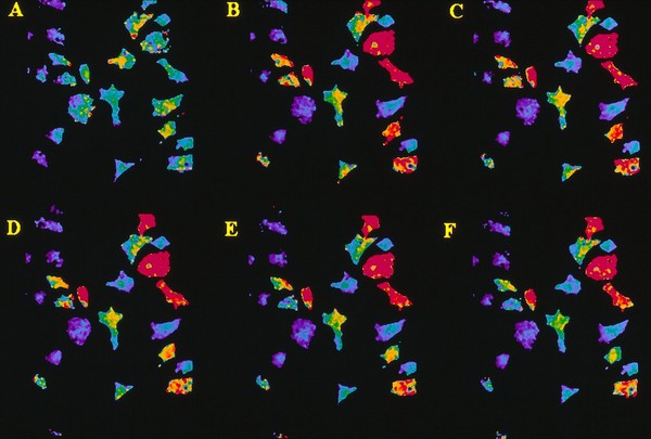 Fibroblast responses to acetylcholine