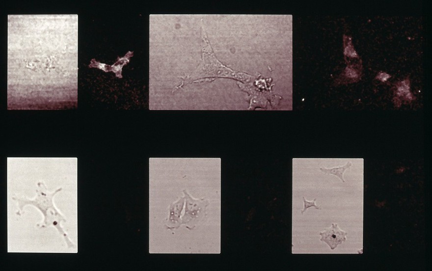 Fibroblast responses to acetylcholine