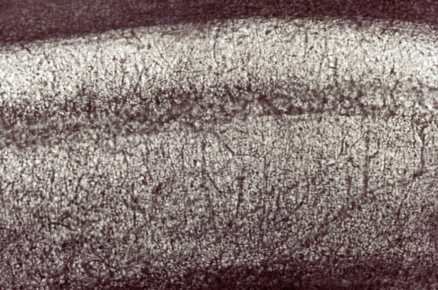 Neurons in hippocampus