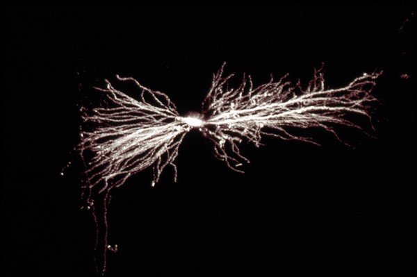 Interneuron in hippocampus