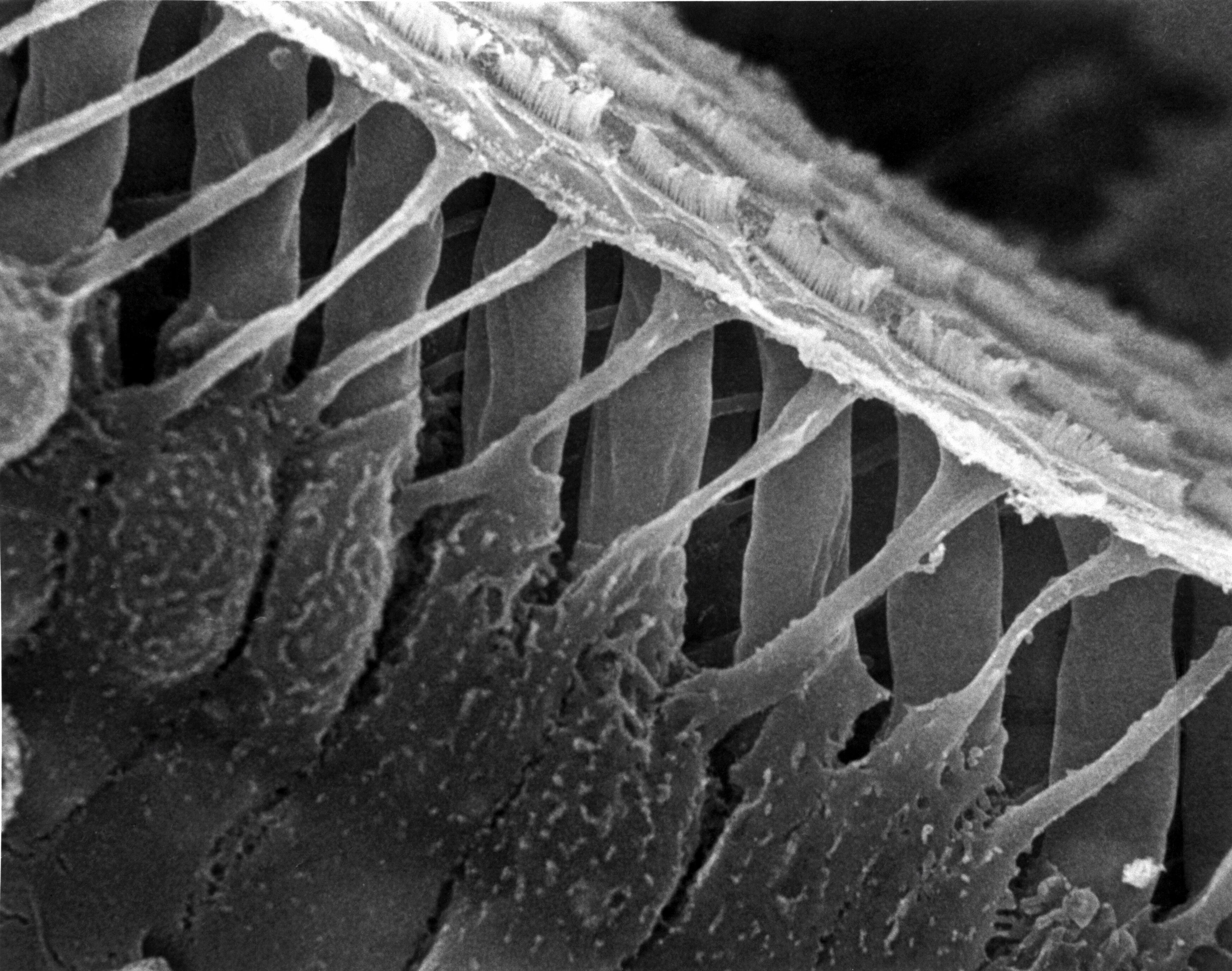 Deiter's cells & outer hair cells, cochlea | Wellcome Collection Deiter's cells & outer hair cells, cochlea | Wellcome Collection