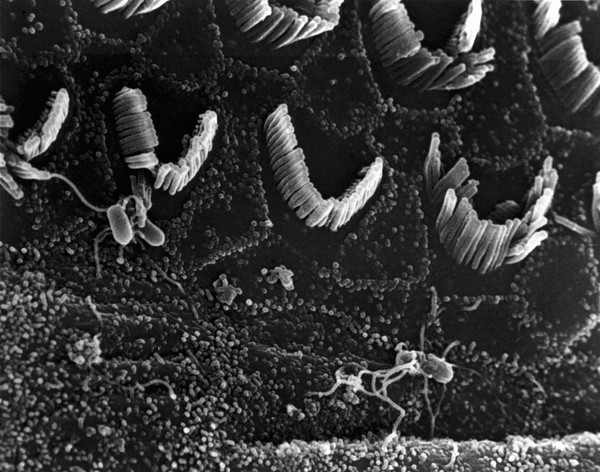 SEM cochlea damaged by bacterial meningitis
