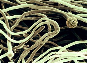 view Aspergillus hyphae showing 2 conidiophores