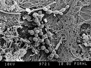 view Yeasts in tooth with plaque.