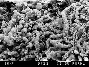 view 'corn on the cob' in concavity of tooth cusp