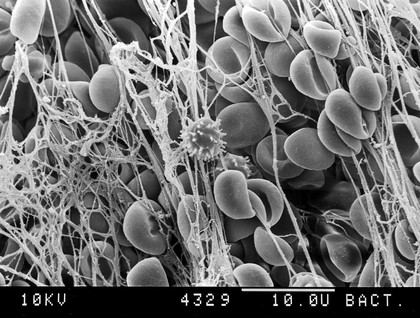 Electron micrograph of blood clot,high power