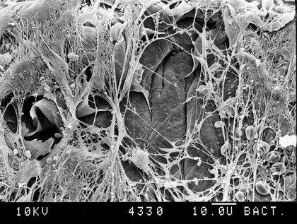 SEM of blood clot, new cells under fibrin