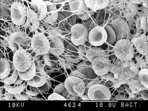 view SEM of blood clot