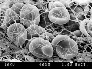 view SEM of blood clot, close-up.