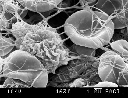 SEM of blood clot + one white corpuscle.
