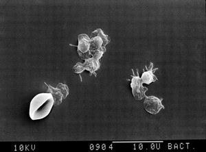 view SEM of platelets and red blood corpuscle