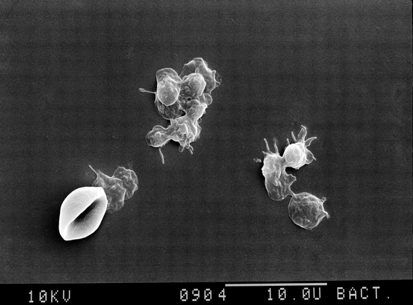 SEM of platelets and red blood corpuscle