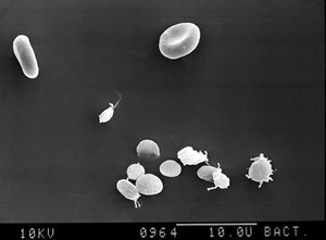 view SEM of rbcs, discoid & stimulated platelets