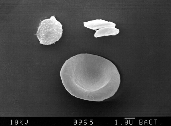 SEM of rbcs, discoid & stimulated platelets