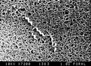 view SEM of Campylobacter