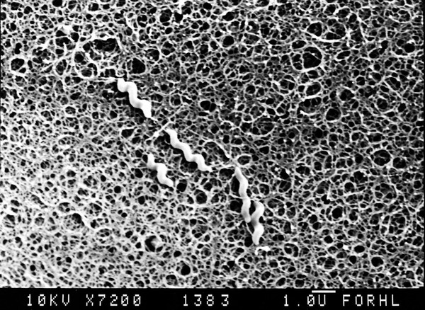 SEM of Campylobacter