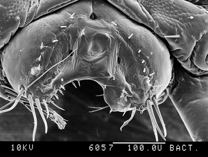 Pubic louse, tip of tail, SEM