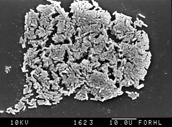 SEM of E.coli