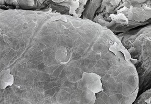 view Tongue, taste bud on fungiform papilla. SEM