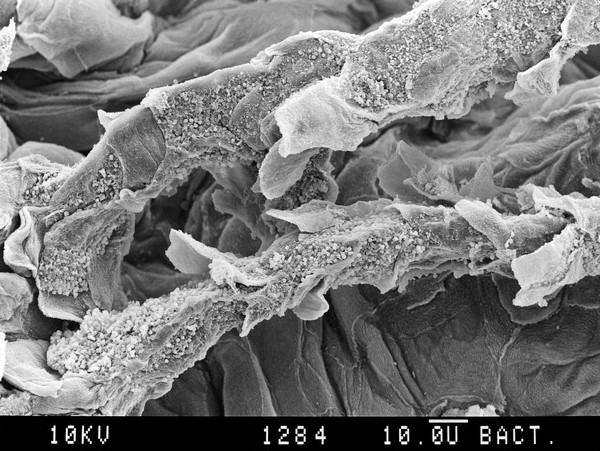 Tongue, scales on filiform papillae. SEM