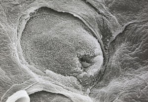 view Tongue, including taste bud. SEM