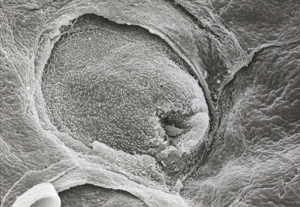 Tongue, including taste bud. SEM