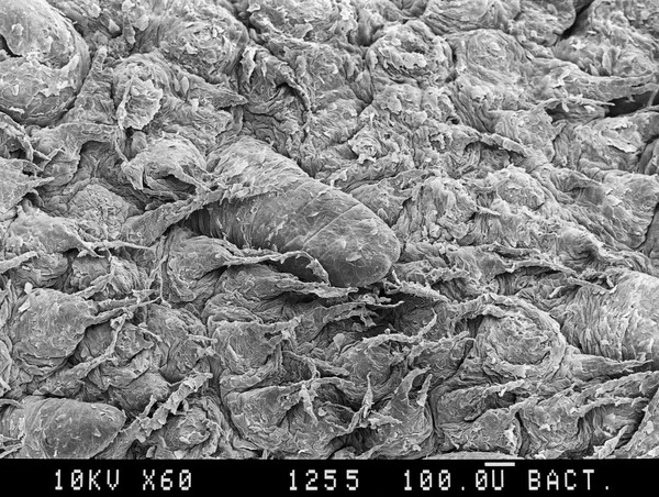 Tongue, including taste bud. SEM