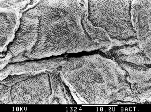 Tongue, squames on fungiform papilla. SEM