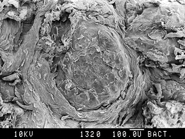 Tongue, fungiform papilla. SEM