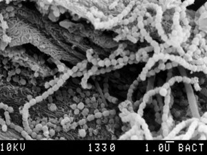 view Chains of streptococci on tongue, SEM