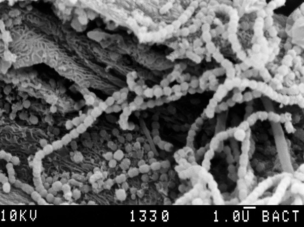 Chains of streptococci on tongue, SEM