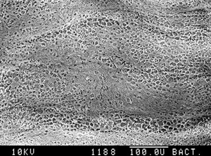 view Human bronchus, SEM