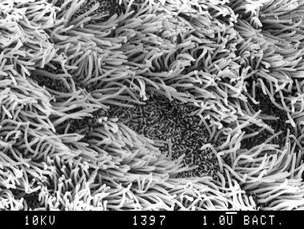 Bronchus, SEM