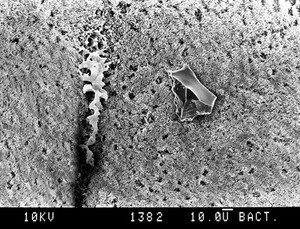 view Bronchus, mucus and dust particle, SEM