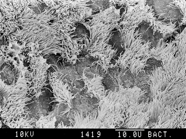 Bronchus, goblet cell hyperplasia, SEM
