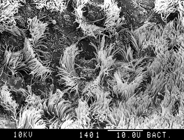 Bronchus, area of hyperplasia. SEM
