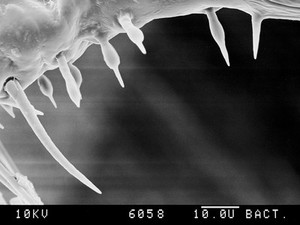 view Pubic louse, tail end, CU spikes, SEM.