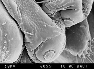 view Pubic louse, suckers on tail piece, SEM.