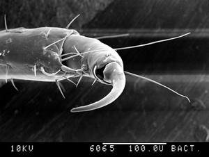 view Public louse, 1st claw of 2nd leg, SEM.