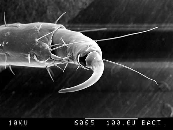 Public louse, 1st claw of 2nd leg, SEM.