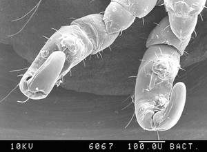 view Pubic louse, 2nd & 3rd claws, SEM.